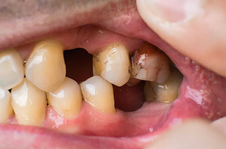 痛みに配慮した治療