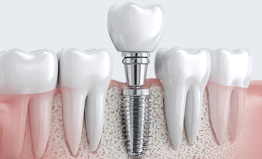豊富な治療の選択肢