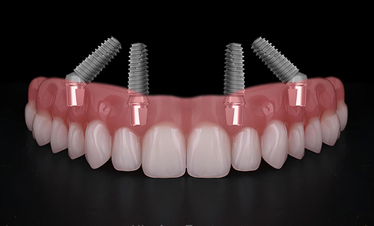 重度の症例にも対応が可能